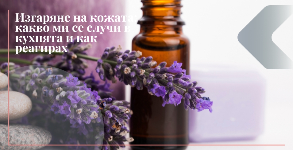 Изгаряне на кожата: какво ми се случи в кухнята и как реагирах
