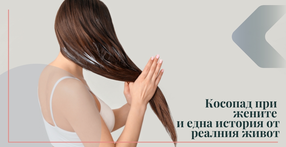 Косопад при жените и една история от реалния живот